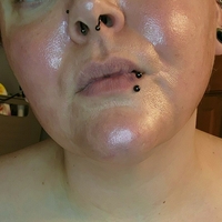 blemishedbeauty Nahé