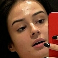 Lauraysergii Nahé