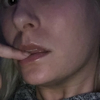 sickbeastblahblah Nahé