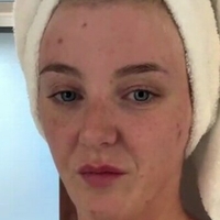 VictoriaPatton Nahé